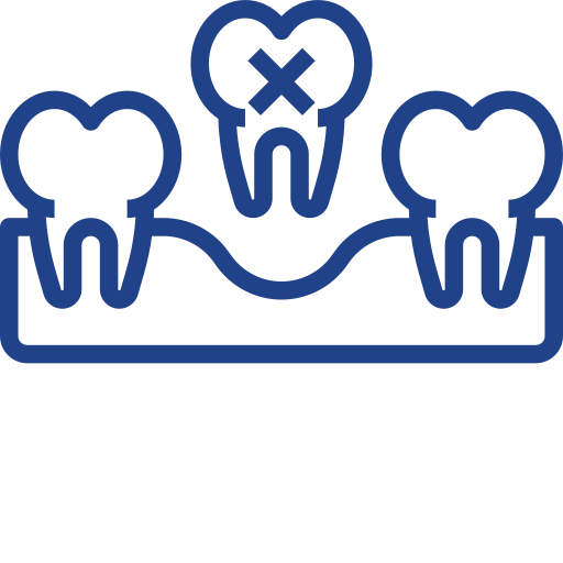 Long-Term Solution For Tooth Loss